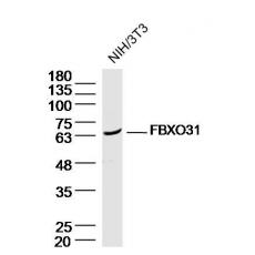 Anti-FBXO31 antibody