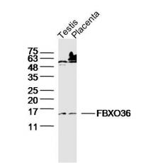Anti-FBXO36 antibody