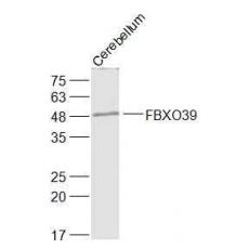 Anti-FBXO39 antibody