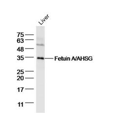 Anti-Fetuin A/AHSG antibody