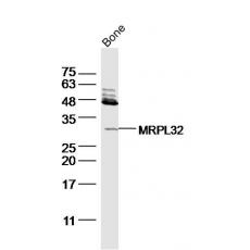 Anti-FGF23 antibody