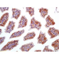 Anti-FGFBP1 antibody