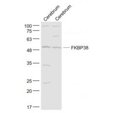 Anti-FKBP38 antibody