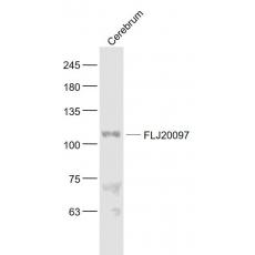 Anti-FLJ20097 antibody