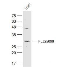 Anti-FLJ25006 antibody