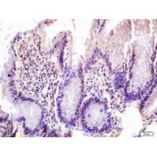 Anti-FOXN1 antibody