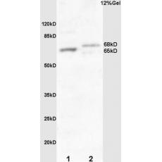 Anti-Frizzled 10/CD350 antibody