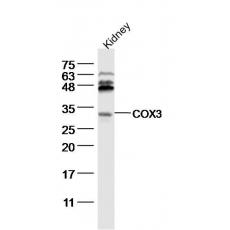 Anti-LTK antibody