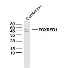 Anti-FOXRED1 antibody