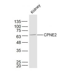 Anti-CPNE2 antibody