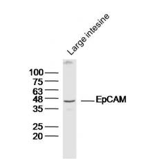 Anti-CRELD2 antibody