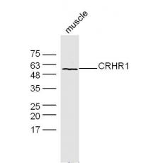 Anti-CRHR1 antibody