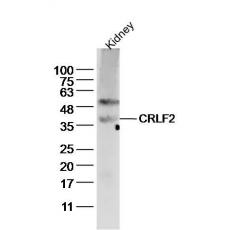 Anti-CRLF2 antibody