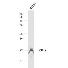Anti-CPLX1 antibody