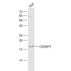 Anti-CRABP1/Retinol binding protein antibody