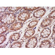 Anti-COQ6 antibody