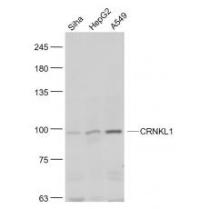 Anti-CRNKL1 antibody