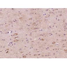 Anti-CSEN antibody