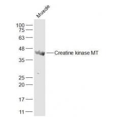 Anti-Creatine kinase MT antibody