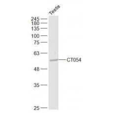 Anti-CT054 antibody