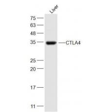 Anti-CTLA4 antibody