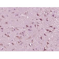 Anti-CWH43 antibody
