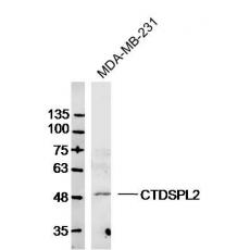 Anti-CTDSPL2 antibody