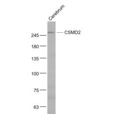Anti-CSMD2 antibody