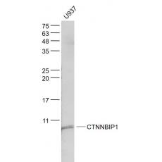Anti-CTNNBIP1 antibody
