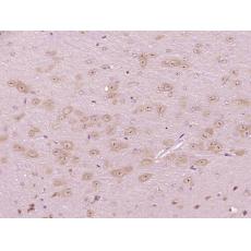 Anti-CXorf36 antibody