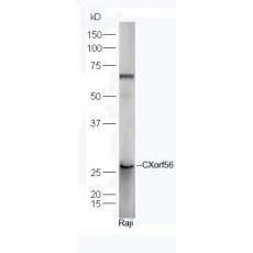 Anti-CXorf56 antibody