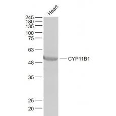 Anti-CYP11B1 antibody