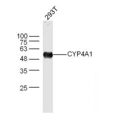 Anti-CYP4A1 antibody