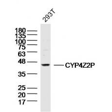 Anti-CYP4Z2P antibody