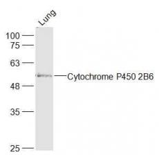 Anti-Cytochrome P450 2B6 antibody