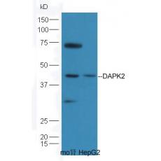 Anti-DAPK2 antibody