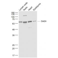 Anti-DAZ4 antibody