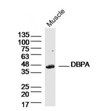Anti-DBPA antibody