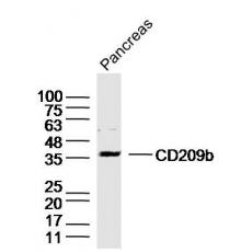 Anti-DC-SIGNR1/CD209b antibody