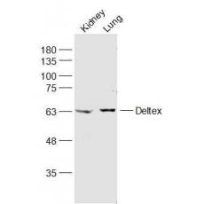 Anti-Deltex antibody