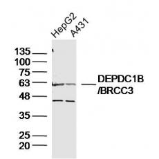 Anti-DEPDC1B/BRCC3 antibody