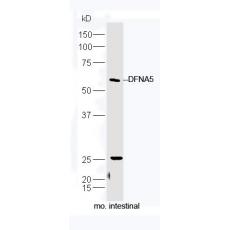 Anti-DFNA5 antibody