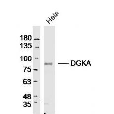 Anti-DGKA antibody