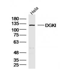 Anti-DGKI antibody