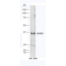 Anti-DHDH antibody
