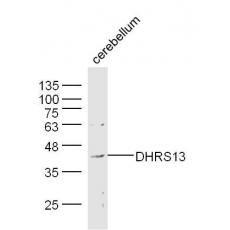 Anti-DHRS13 antibody