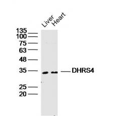 Anti-DHRS4 antibody