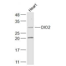 Anti-DIO2 antibody