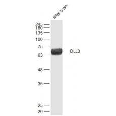 Anti-DLL3 antibody