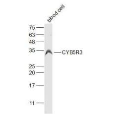 Anti-CYB5R3 antibody